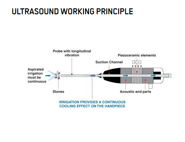 Материал PZT Пьезоэрамика кольцо пьезокерамические преобразователи для ультразвуковой литотрипсии